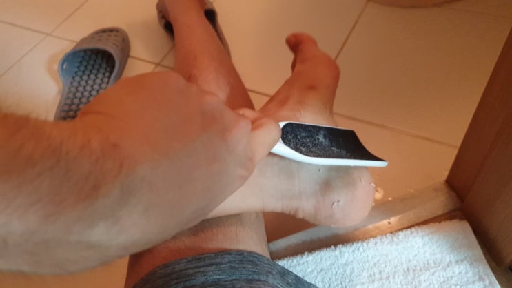  발뒤꿈치각질 스트레스 많이 받죠? 셀로몬 발각질 제거제 이걸로 해결