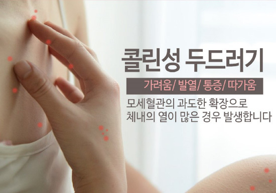  콜린성 두드러기란?
