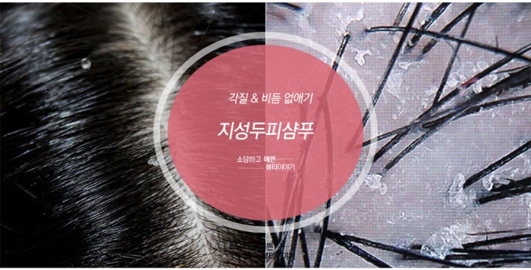  지성두피샴푸 유분많은 두피상태 소유자 모집중