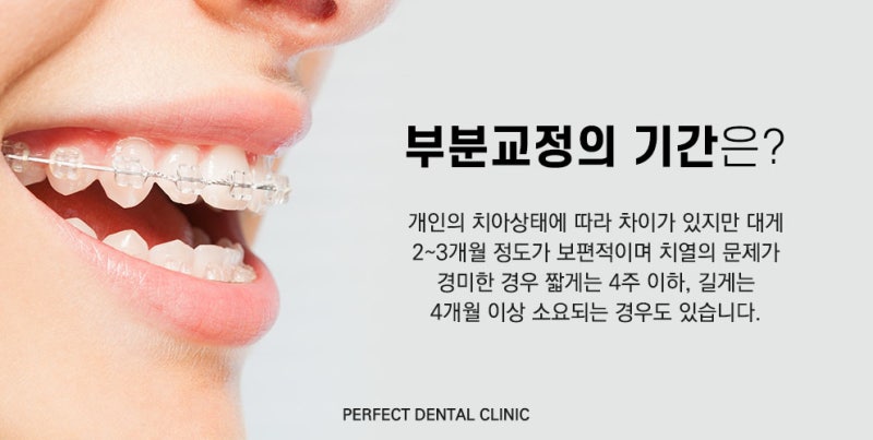 대구 치열교정 전후 후기 덧니교정 비용의 가격은? 2