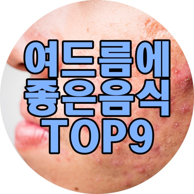  여드름에 좋은 음식 이건 꼭 알아야해요