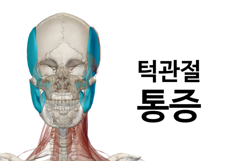 턱관절 통증은 초기부터 치료해주시는 것이 좋습니다[영통역 새움한의원]