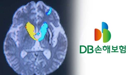 교통사고 이후 40대에 치매 판정…보험금 못 준다는 DB손보 