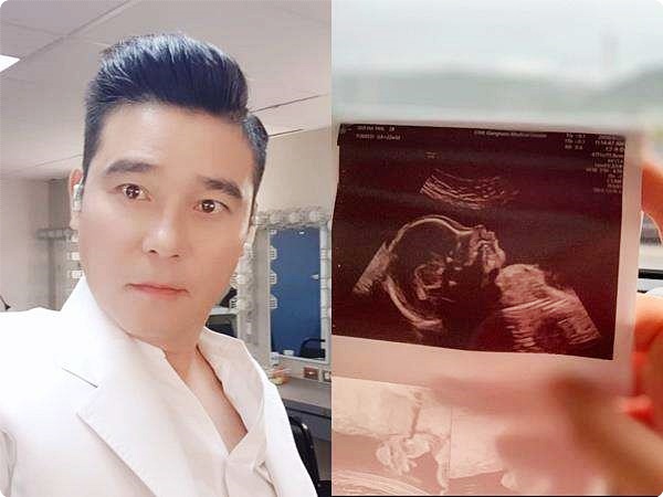  임창정 다섯아이 아빠/전부인/18연하 아내 서하얀/나이/제주도집