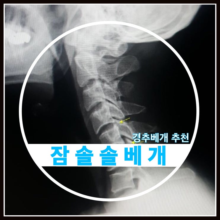 경추베개 추천 잠솔솔베개 경추베개 추천 잠솔솔베개
