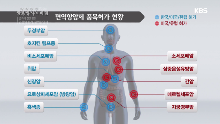 [제약, 바이오] 생로병사의 비밀 700회 - 면역항암제(keytruda(pembrolizumab))