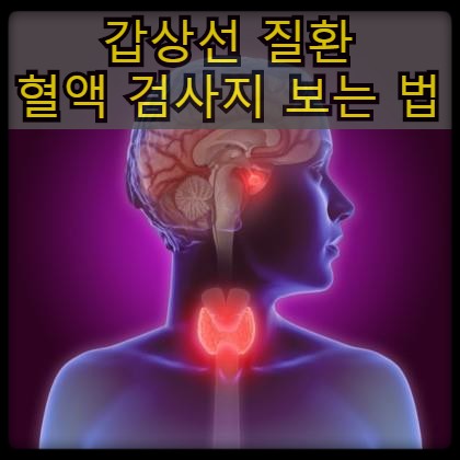  갑상샘항진증 (갑상선기능항진증) - 혈액 검사표 수치의 의미