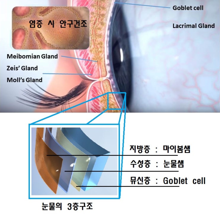  안구건조증 - 눈의 3층구조 회복을 위한 관리