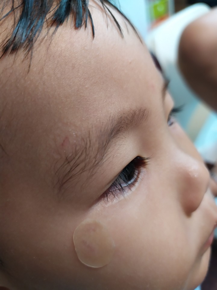  우리 막둥이, 얼집에서 꼬집힘 당해 맴찢 ㅠㅠ