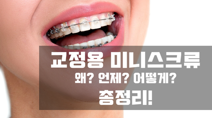 교정용 미니스크류, 무엇이고, 식립 후 주의사항은? - 총정리 교정용 미니스크류, 무엇이고, 식립 후 주의사항은? - 총정리