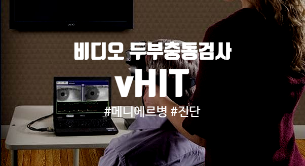 메니에르병 진단에 도움을 주는 비디오 두부충동검사(vHIT)