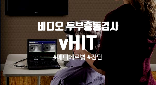  메니에르병 진단에 도움을 주는 비디오 두부충동검사(vHIT)