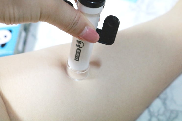  모기침 제거기 괜찮은듯??