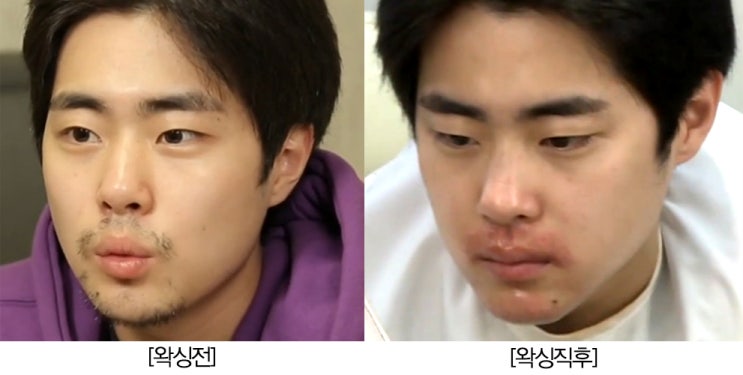  '나 혼자 산다' 조병규 수염 왁싱