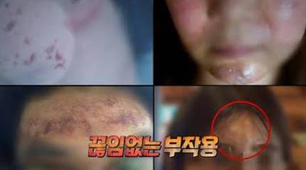  실화탐사대 피부과 홍원장은 무면허의 연극배우