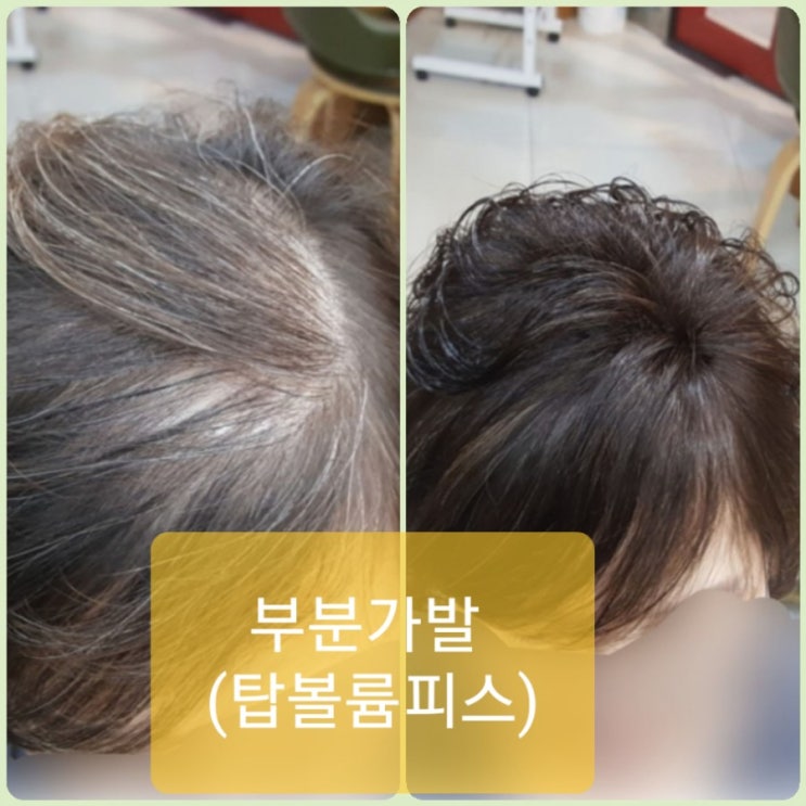 여자만 올까요? 갱년기? 피해 갈 수 없는 갱년기라면? 제대로 알아보고 즐겁게 극복하자구요~[춘천가발][춘천가발전문점]