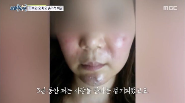  실화탐사대 후기 피부과 홍원장 무면허 연극배우