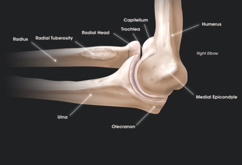 Elbow posterior dislocation : 네이버 블로그