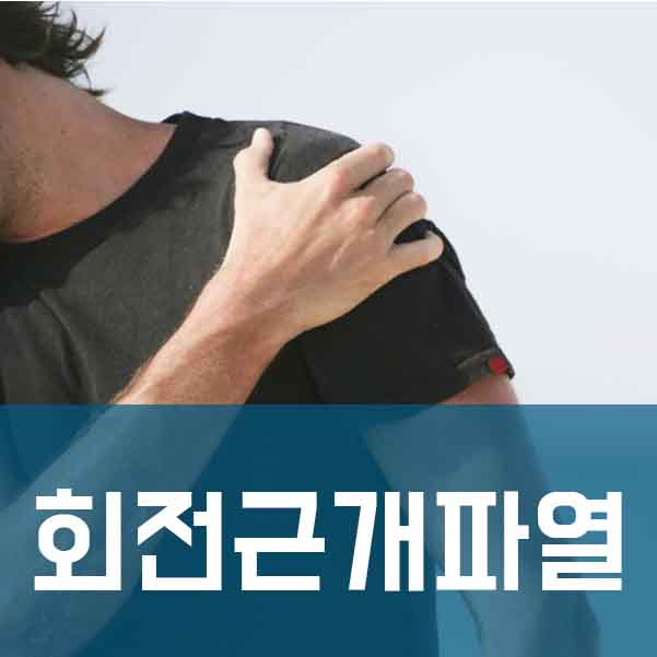  어깨통증 유발하는 회전근개파열, 어떤치료가 필요할까 [삼성본병원]