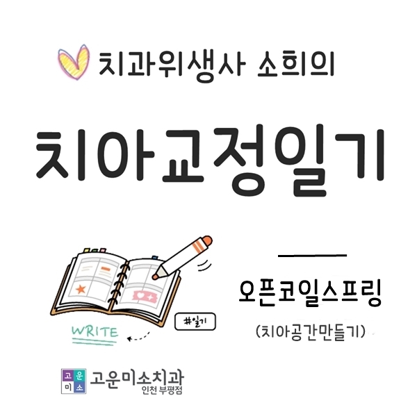  소희의 교정일기_6) 오픈코일스프링으로 치아공간만들기