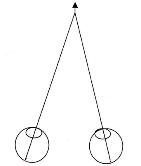  [오연식 박사, 약시 재활 훈련 2001년 시작, 약시, 시력회복, 난독증, 복시, 간헐성외사시, 비전테라피, 사시교정, 약시훈련] 2019. 07. 26.