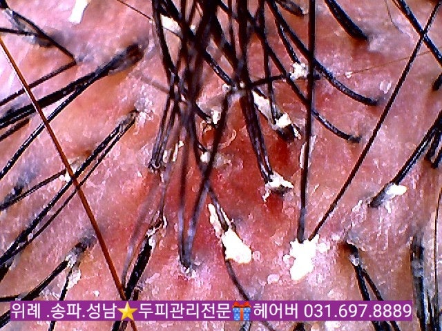 지성 두피 샴푸 정착했습니다 4
