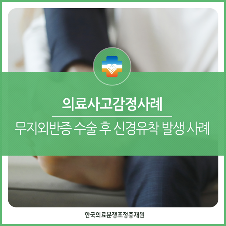  [정형외과 감정사례] 무지외반증 진단하 수술 후 신경유착 발생