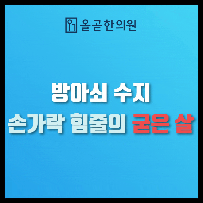 방아쇠 수지 원인 - 손가락 힘줄에 생긴 굳은 살 덩어리 : 네이버 블로그