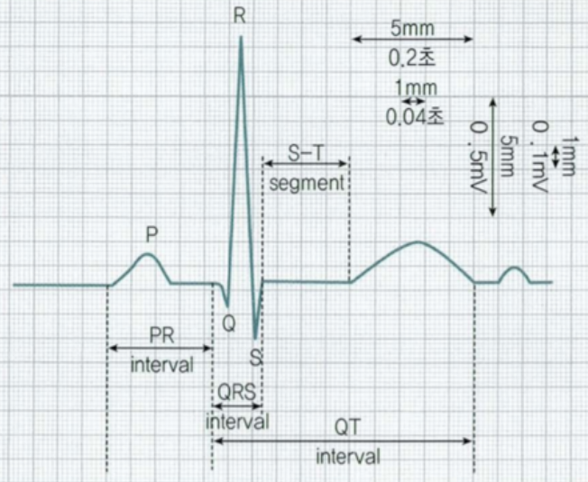 QT 간격연장(prolonged QT interval, long QT time) 신속판단 : 네이버 블로그
