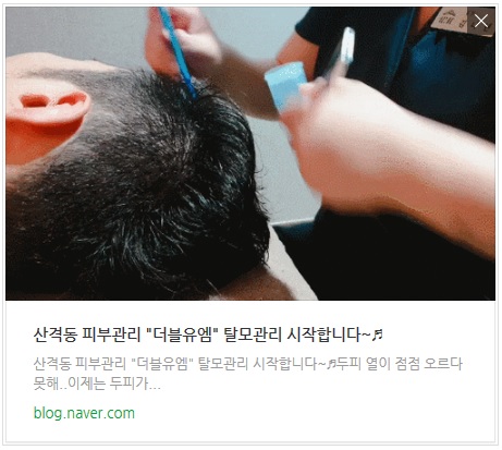  더블유엠 산격점 탈모관리 이용후기 #링크