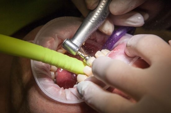 치아 문제로 임플란트 수술 기간이 걱정이 된다면?