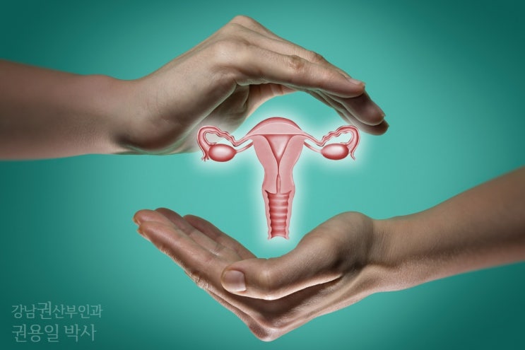 자궁선근증임신 방해, 이것 모르면 자궁 적출한다