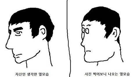 성형해도 못생긴 이유? Feat.두상 : 네이버 블로그