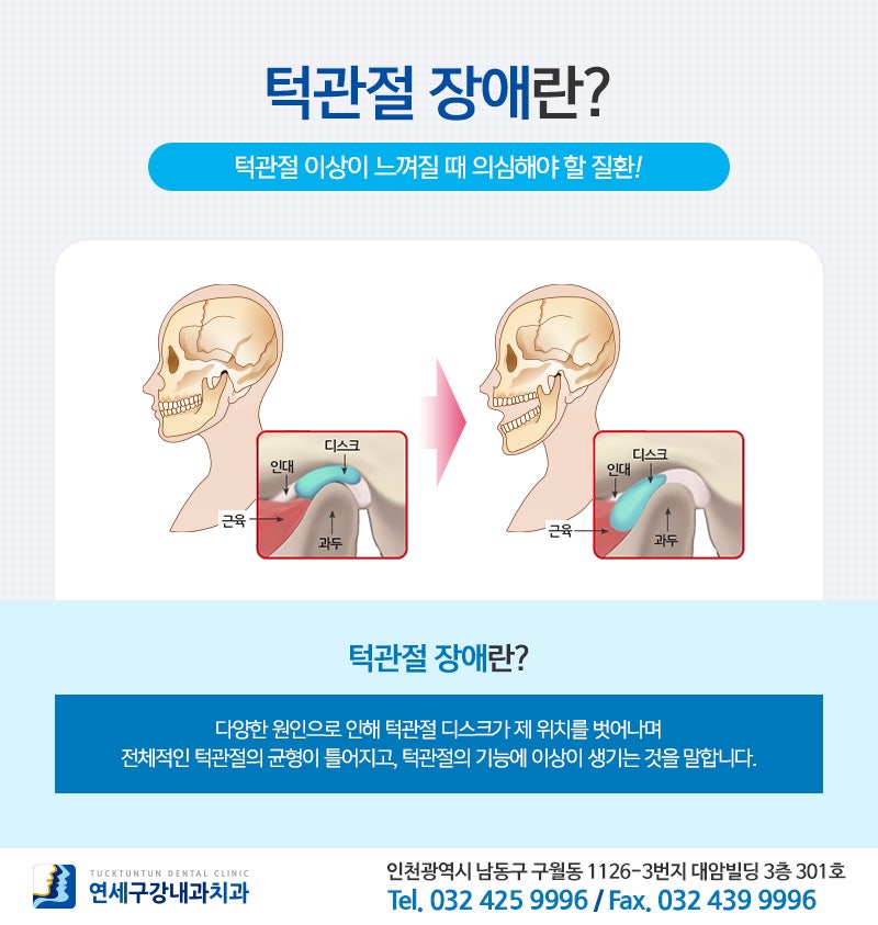 오른쪽 턱 통증, 척추 질환의 징후일 수 있습니다.