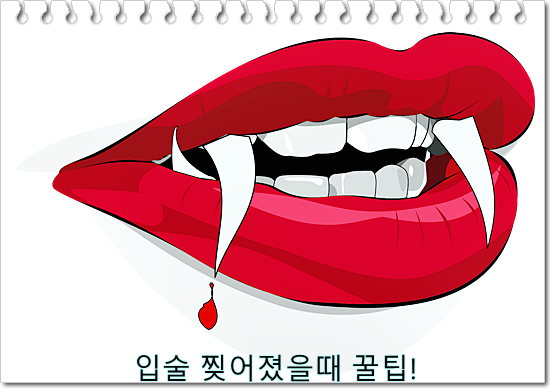  입술 찢어졌을때 꿀팁!