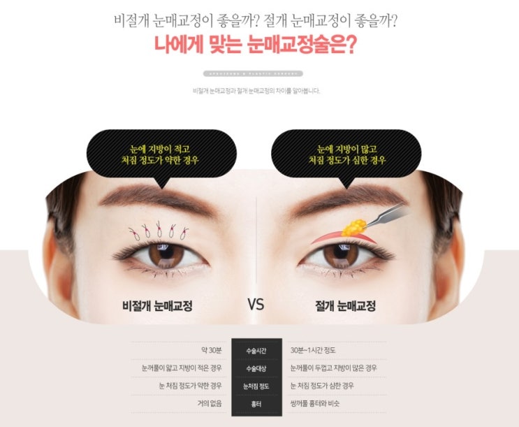 남성의 눈빛 교정 리뷰로 만들어내는 변화! 2