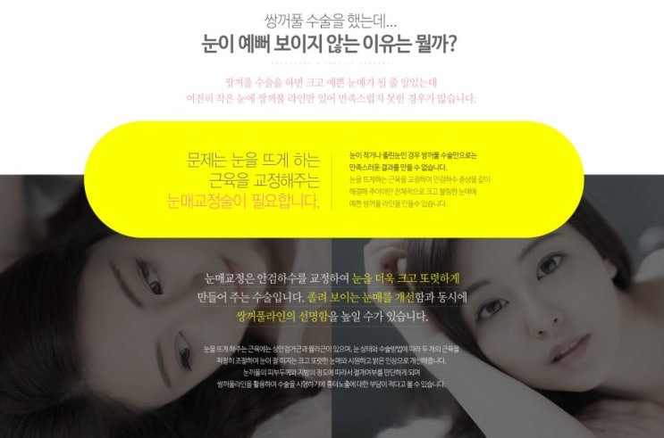 남성의 눈빛 교정 리뷰로 만들어내는 변화! 6