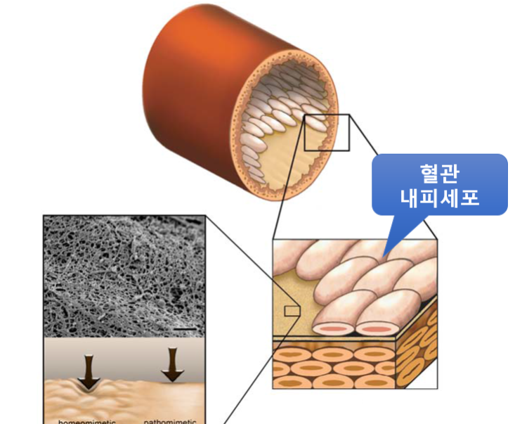  만성 전립선염의 치료- PDE5 억제제