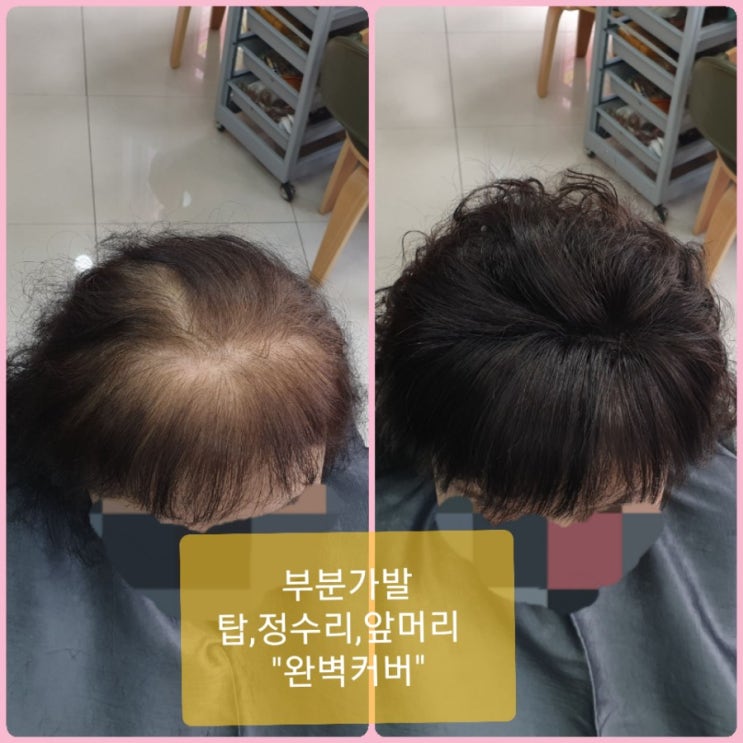  춘천부분가발 혼주업스타일 필수품 [김호증모][춘천가발전문점]