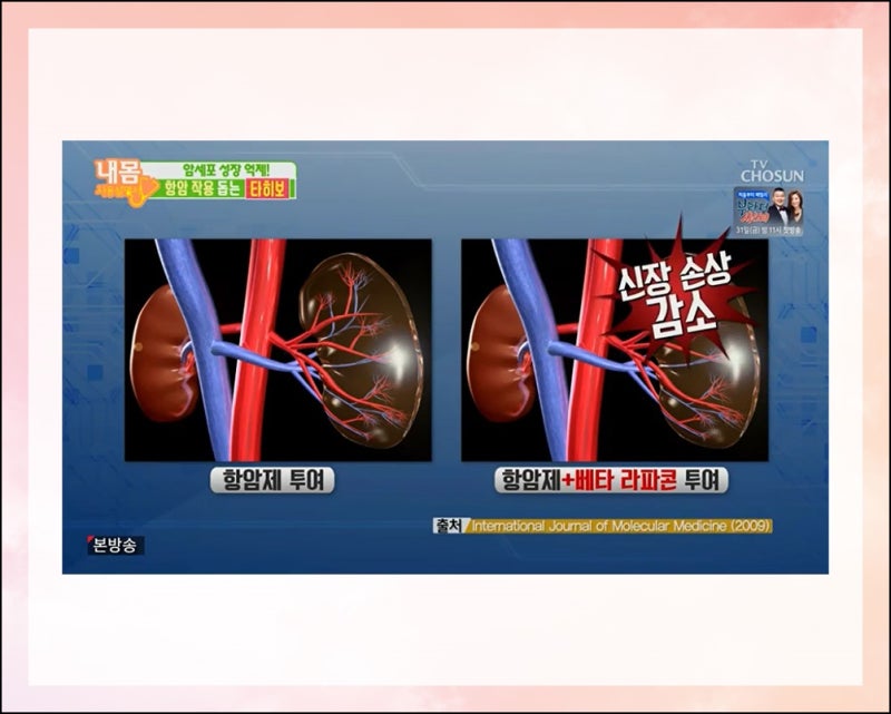 혀 궤양 오래되면 설암 초기증상 일까요 : 네이버 블로그