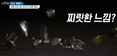  [명의]목이 아프신가요 경추 질환 목 통증 김근수 교수 신경외과 전문의 병원 어디 어깨 날개뼈 견갑골 통증 목 디스크 연성 경성 근막통증증후군 경추 척추관 협착증 확장술 625회