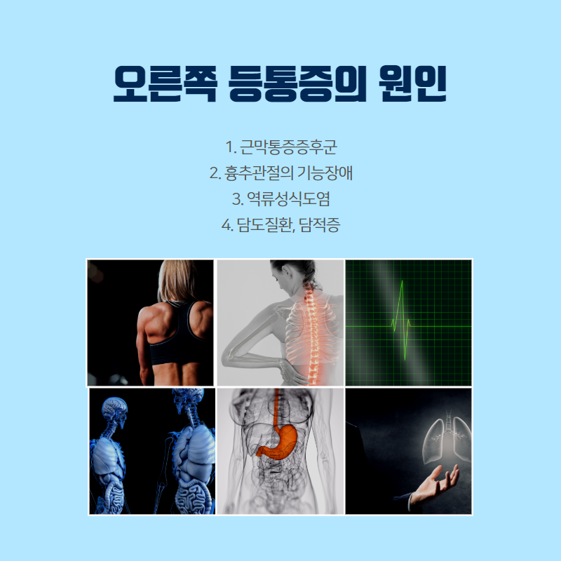 역류성 식도염 등통증이 발생하는 이유