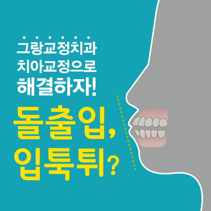[대전교정치과] 서울브라운치과 돌출구 교정으로 웃음 찾기 7