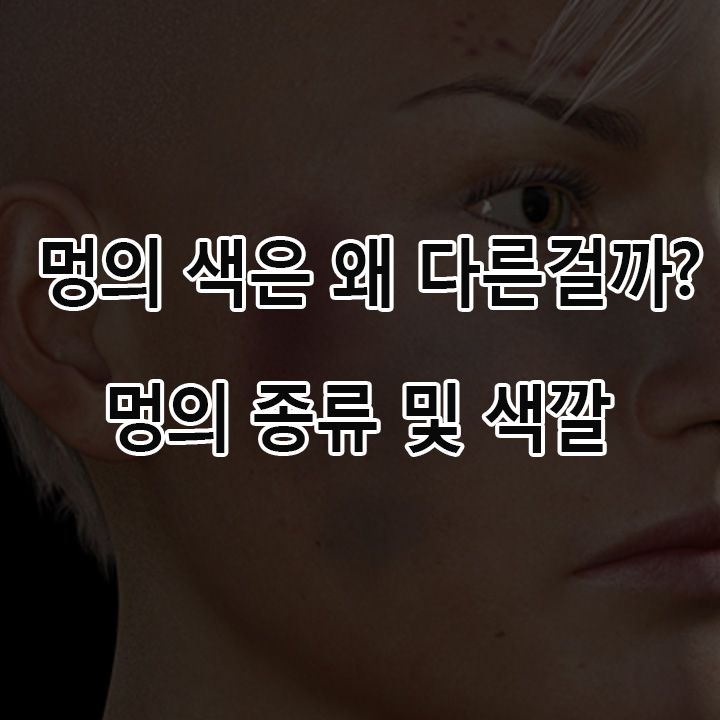  멍이 들때 왜 색이 다른 걸까? 멍의 색깔 및 종류 및 개선방법에 대해 알아보자!