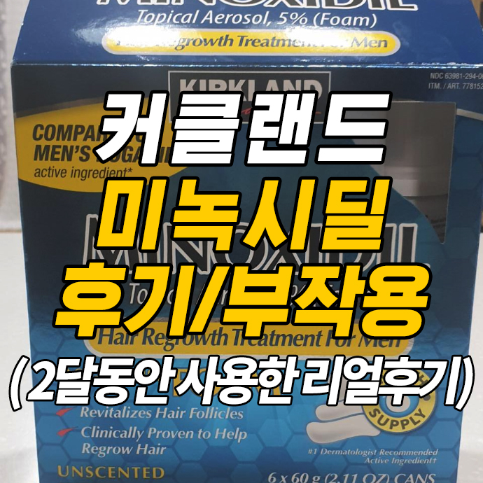 커클랜드 미녹시딜 후기, 부작용, 쉐딩현상 minoxidil