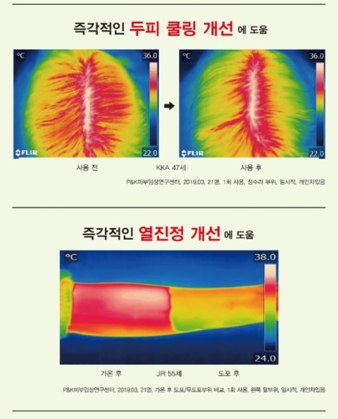  (생활) 두피케어 CH6 스칼프 싹세럼으로 탈모셀프 케어와 건강한 두피와 모발 만들기