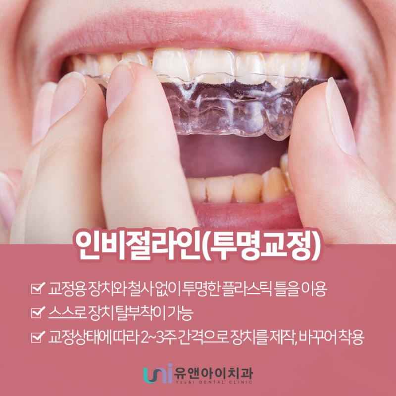 부산투명교정 인비절라인과 다른 점은 1