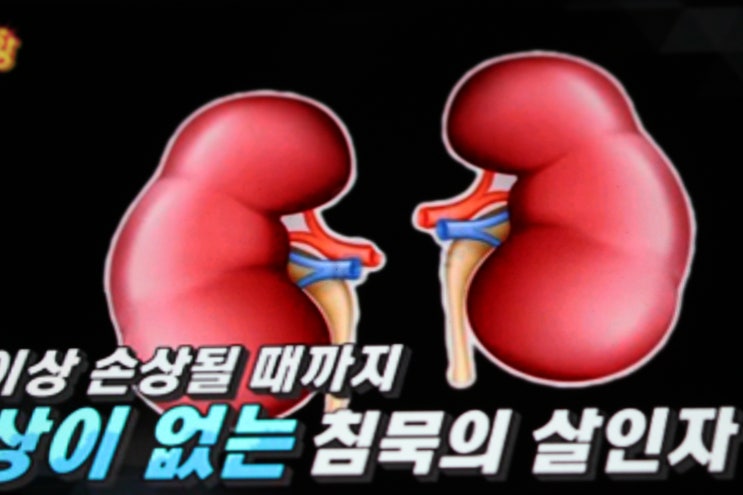  신장질환 증상, 안좋을때 좋은 음식은?