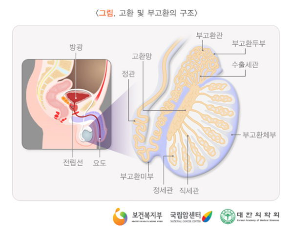 고환암 자가진단해보세요! : 네이버 블로그 고환암 자가진단해보세요! : 네이버 블로그