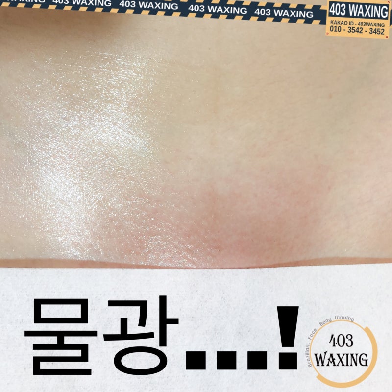 ê´'ì•ˆë¦¬ ë¸Œë¼ì§ˆë¦¬ì–¸ì™ì‹± ì „í›„ ì‚¬ì§„ ë° ë¸Œë¼ì§ˆë¦¬ì–¸ ì™ì‹± ì¢…ë¥˜ ë„¤ì´ë²„ ë¸